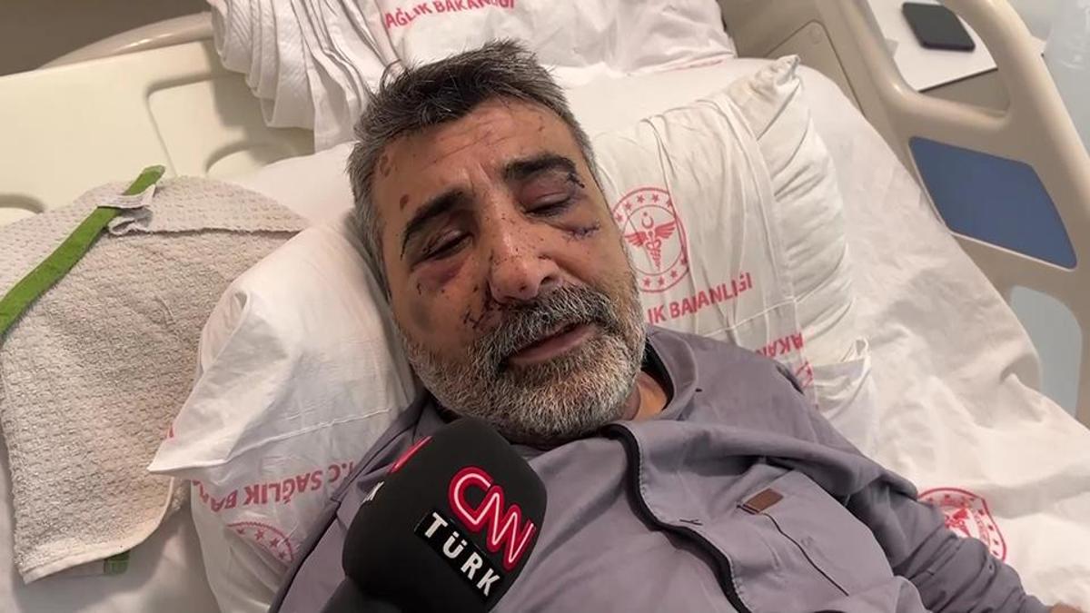 İngiliz boksörün darp ettiği taksici CNN TÜRK’te: “Türkiye’de yargılanmasını istiyorum”